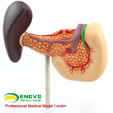 VISCERA06(12543) Medical Science Human Pancreas with Spleen and Duodenum Model